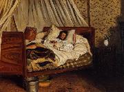 Frederic Bazille Monet after His Accident at the Inn of Chailly oil painting reproduction